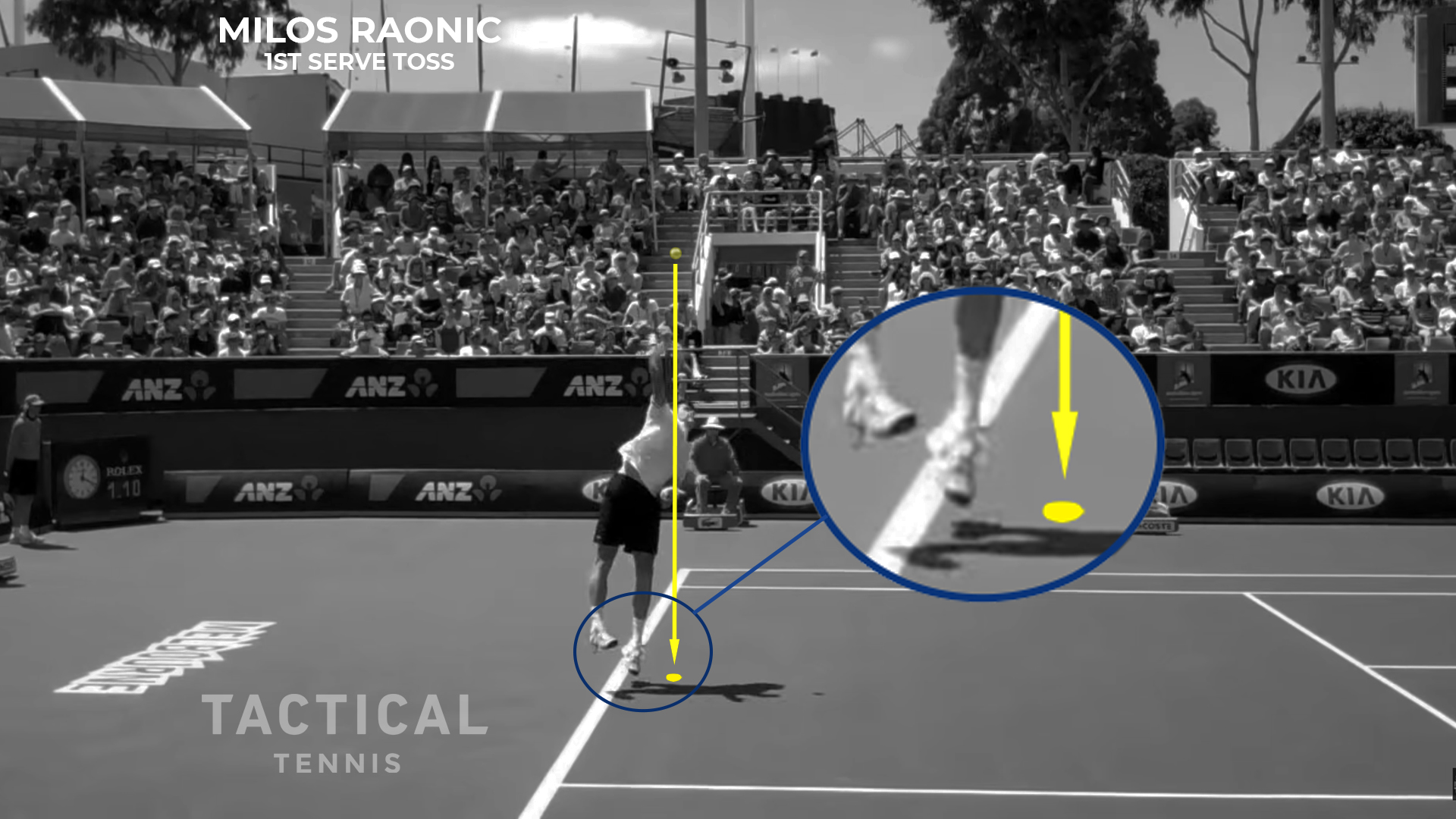 Raonic First Serve Toss Projection
